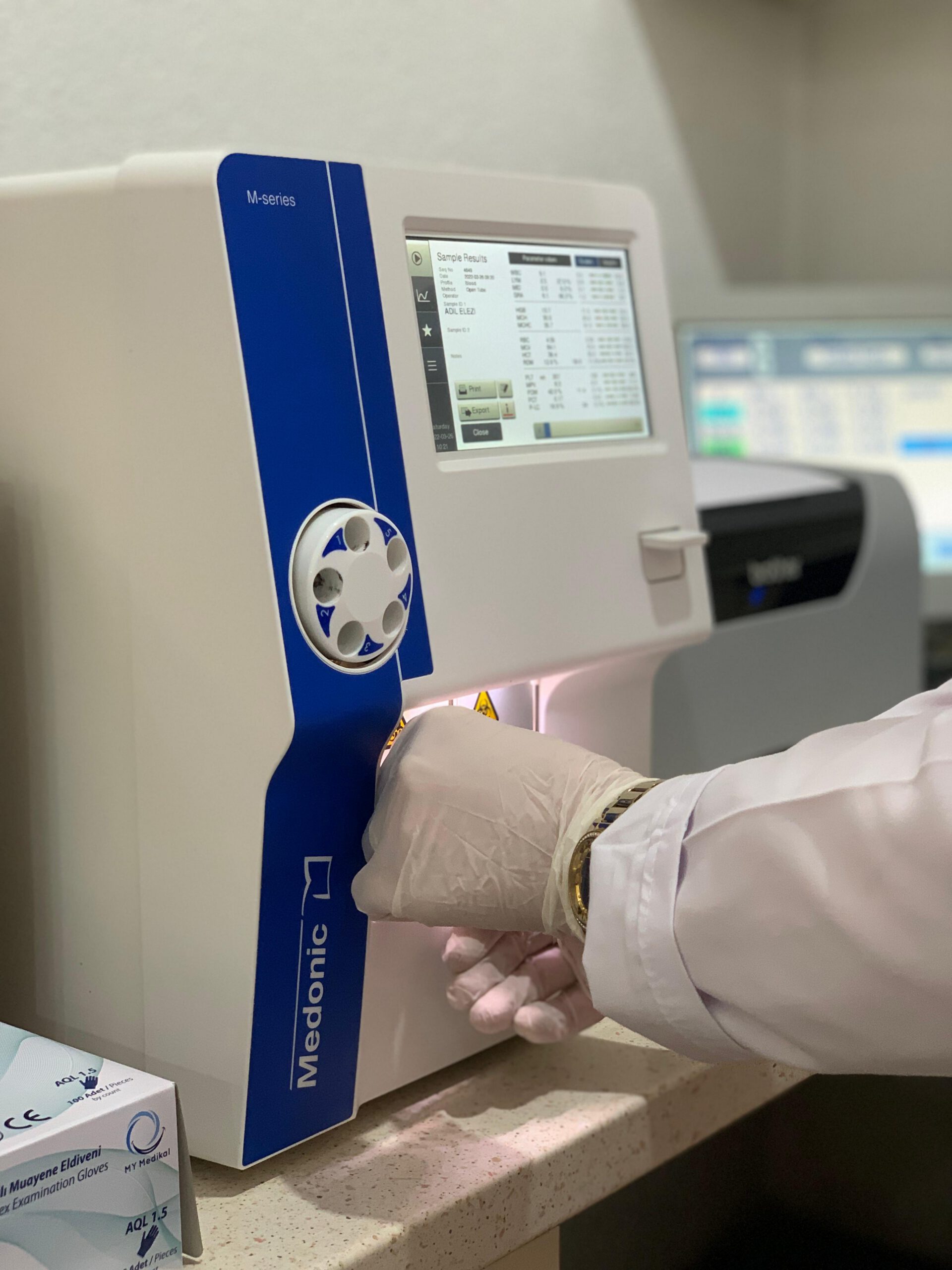 A medical device and a female laboratory technician's hand.